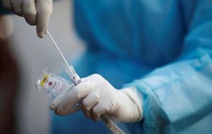93 новых зараженных коронавирусной инфекцией выявили на Кубани